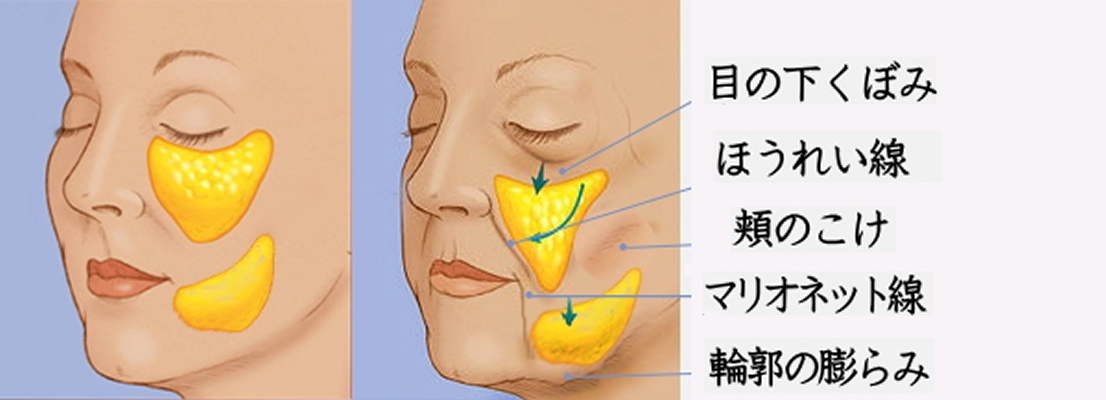 サーマクールを迷っている方へ