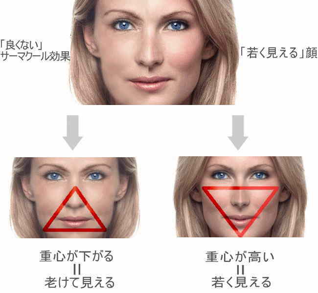 5.サーマクールのマーキング～当院の考え～