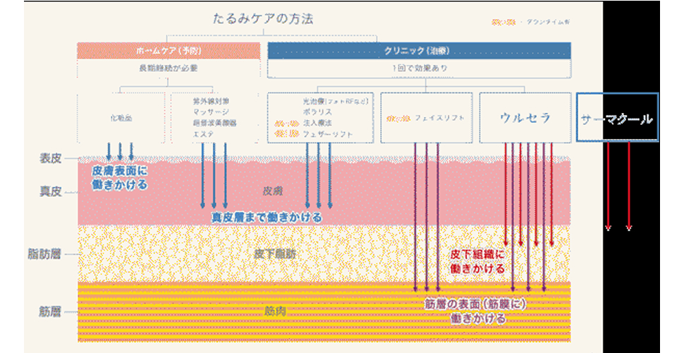 4.サーマクールとウルセラの比較